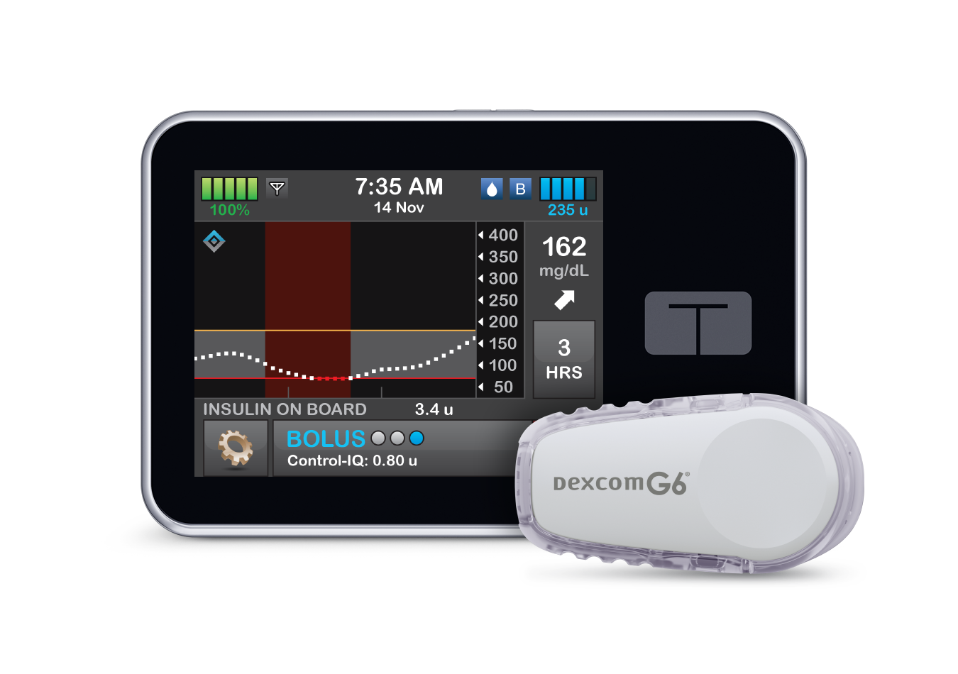 Tandem CCO Brian Hansen Discusses FDA Approval for Control IQ Algorithm with t:slim X2