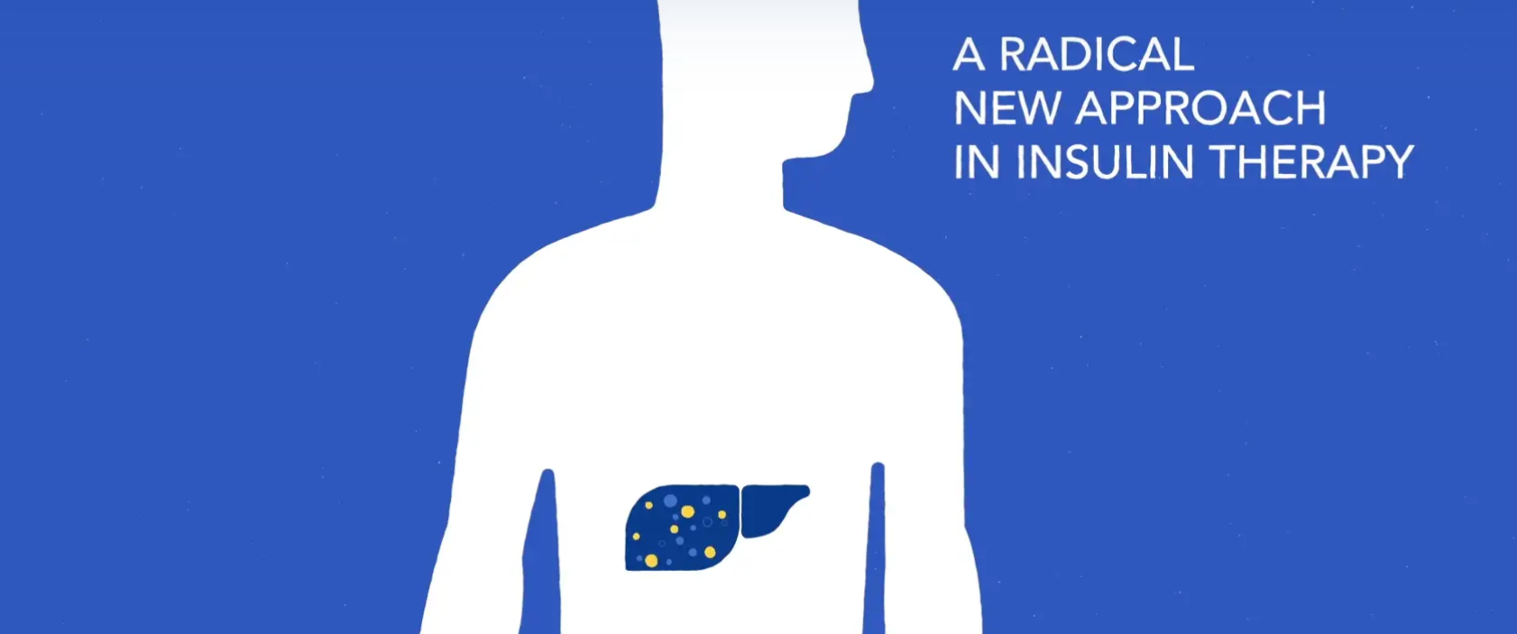 Diasome Announces Positive Results for HDV Insulin Additive to Manage Blood Sugar