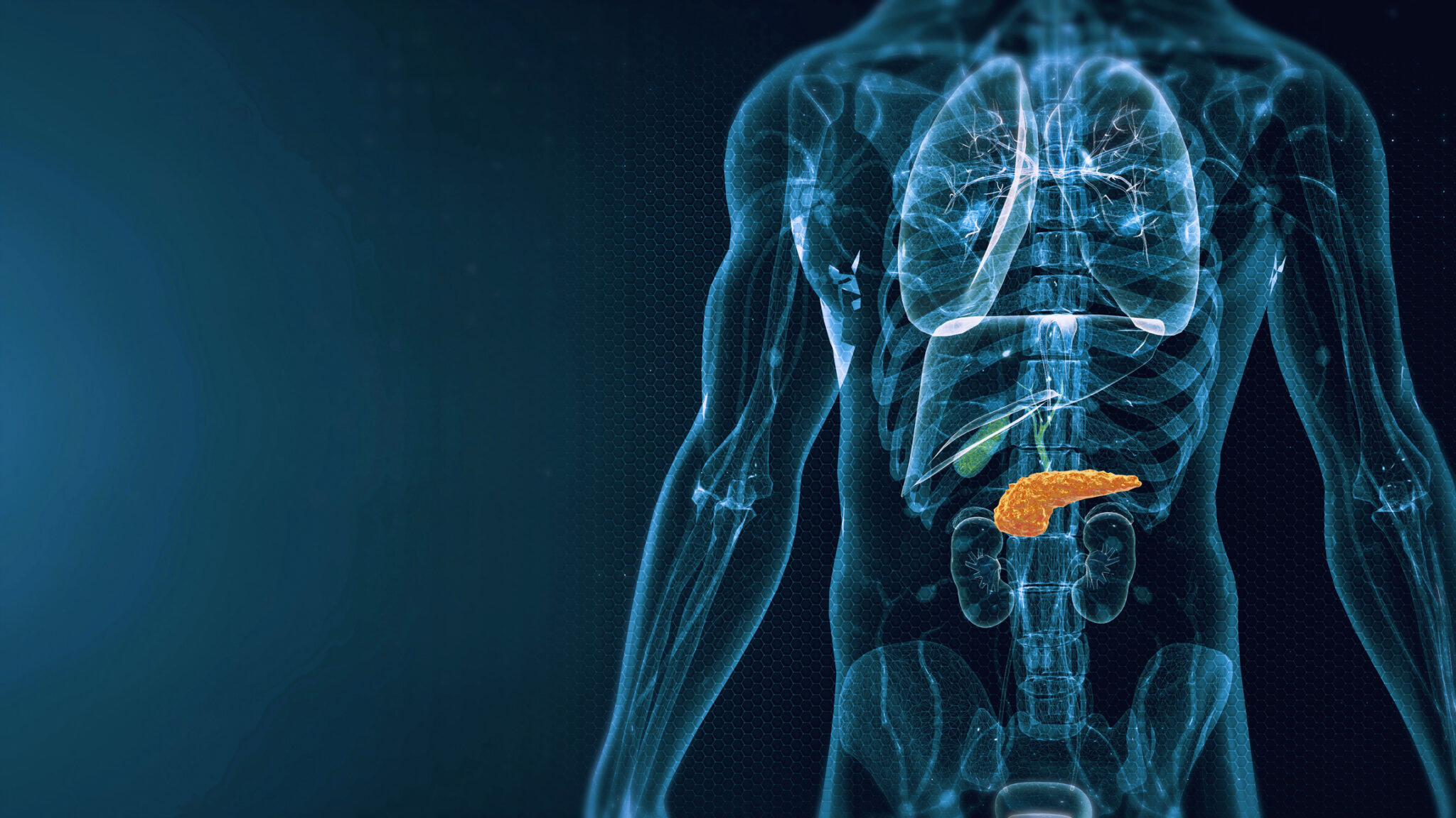 The Six Dysfunctional Hormones of Type 1 Diabetes
