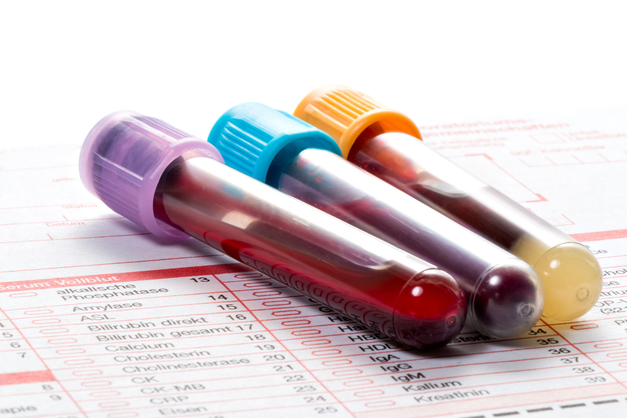 Improving A1c Levels: Diabetes Clinics in T1D Exchange Collaborative Report Significant Progress