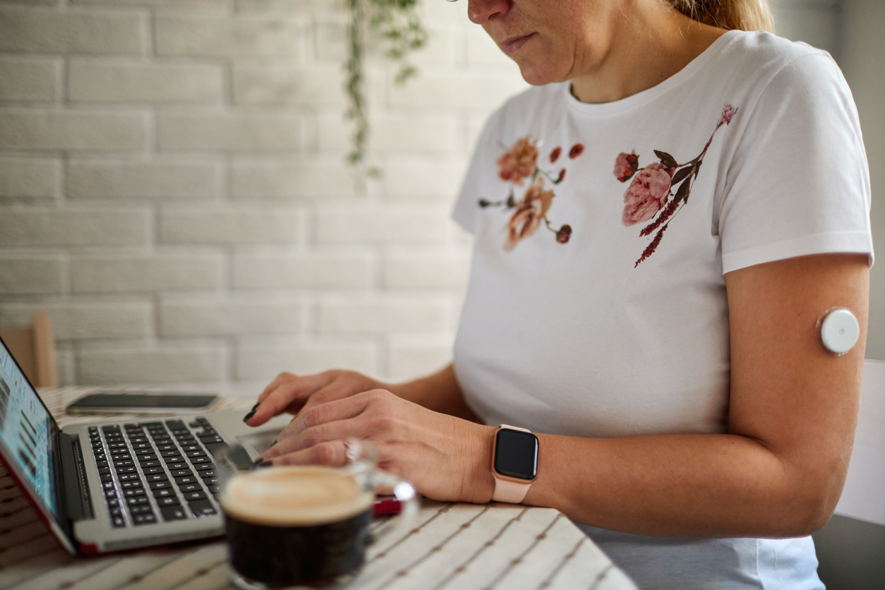 CGM Use and A1c: A transatlantic comparison of the DPV Initiative and T1D Exchange Quality Improvement Collaborative (T1DX-QI)