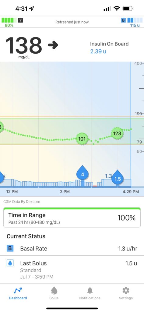 Overpatch Required??? Really? so it's not compatible with my pump and it  requires overpatch per FDA? : r/dexcom