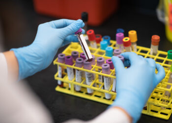Blood Vials Being Placed in a Rack stock photo