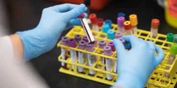 Blood Vials Being Placed in a Rack stock photo